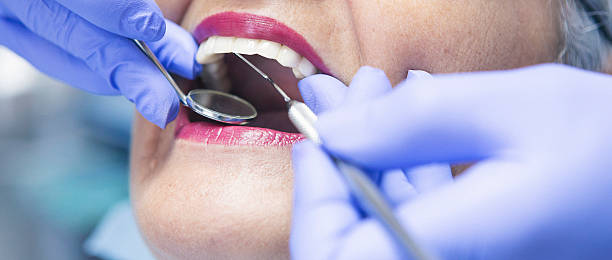 Best Emergency Denture Repair in Wona Lake, IN