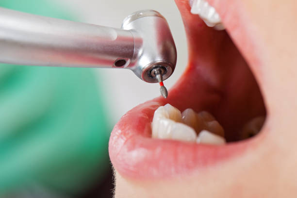 Best Emergency Gum Treatment in Wona Lake, IN